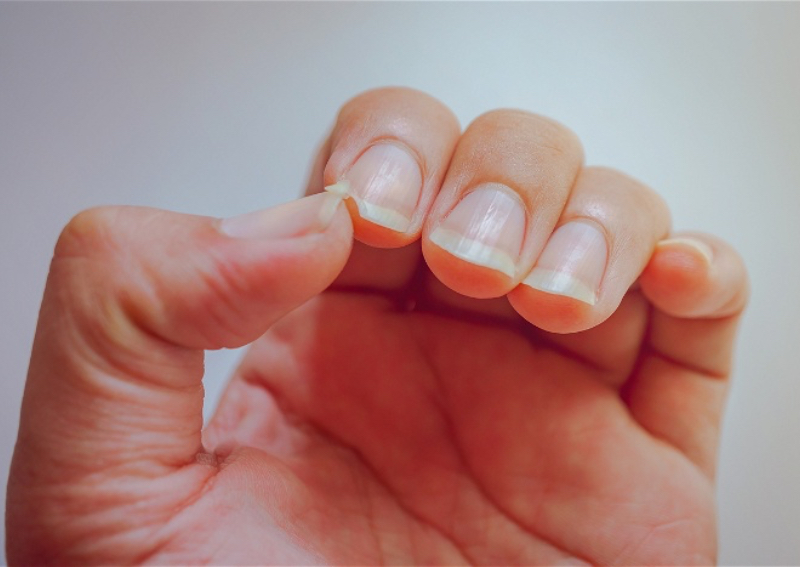 Everything about nails during pregnancy Changes and care tips